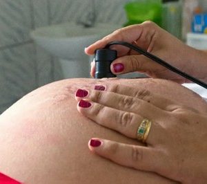 O Ministério Público Federal (MPF) expediu recomendação para que a Assembleia Legislativa do Estado do Amazonas (Aleam) e o Governo do Estado do Amazonas adotem medidas para evitar restrições ao aborto legal. O MPF destaca que a negativa de realização do procedimento legal e seguro, além de ferir o direito à saúde da mulher, configura preconceito em decorrência de gênero e ato de violência contra a mulher, atingindo de forma desproporcional, principalmente, aquelas em condições de vulnerabilidade econômica e social.